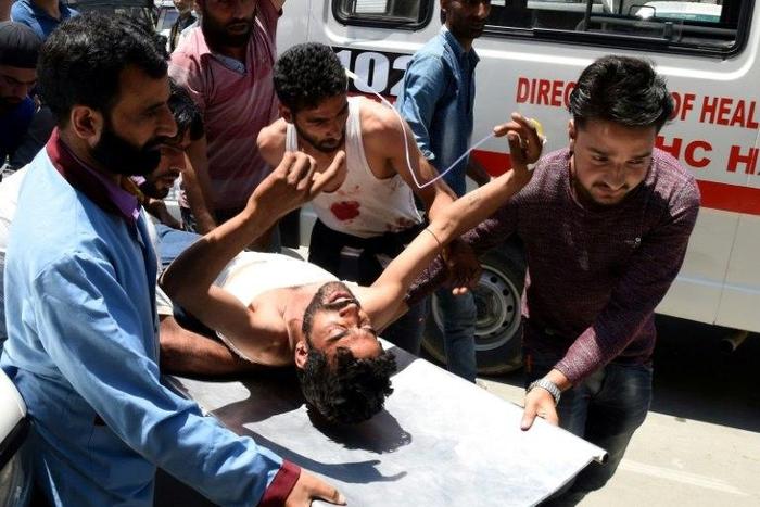 Kashmiri villagers bring a resident injured by Indian security personnel to the main hospital in Srinagar on July 3, 2017