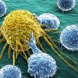 foods might stop cancer from spreading