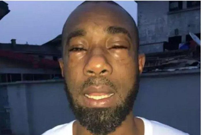 The injured Okechukwu Umesi