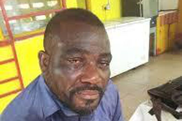 ___6470052___https:______static.pulse.com.gh___webservice___escenic___binary___6470052___2017___4___3___14___Sweating+man