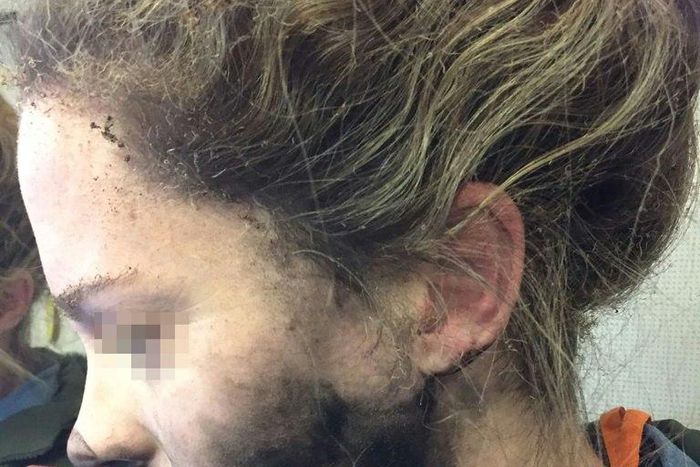 "As I went to turn around I felt burning on my face," the woman said "I grabbed them off and threw them on the floor. They were sparking and had small amounts of fire."