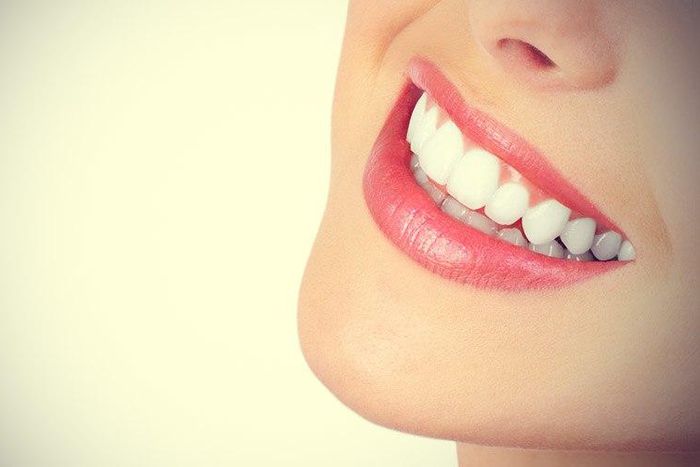 White teeth gives a brighter smile