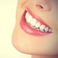 White teeth gives a brighter smile