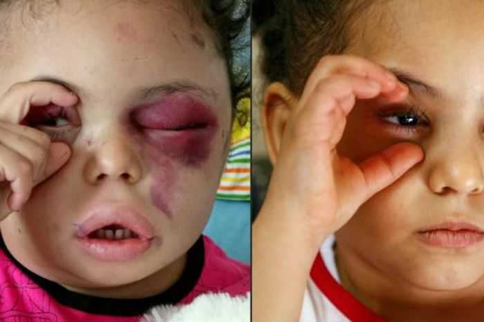 Buthaina Mansur al-Rimi in a photo beamed worldwide after the 2017 air strike that wiped out her immediate family, and today