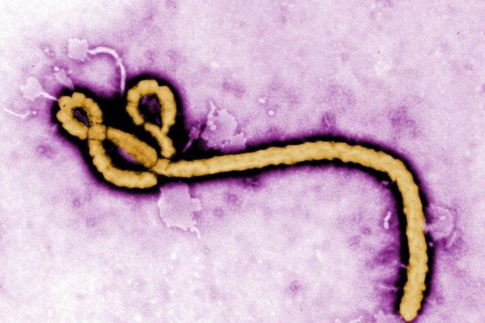 Three-quarters of Ebola survivors had post-disease symptoms when they enrolled for a trial in Guinea about a year, on average, after they were discharged from hospital, researchers reported