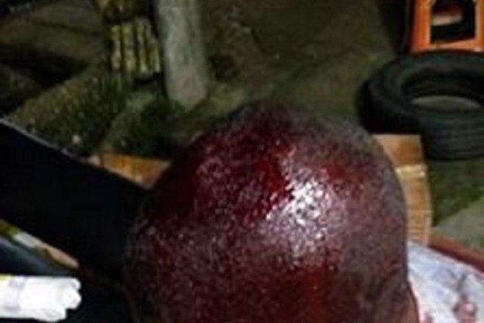 The brutalized police victim