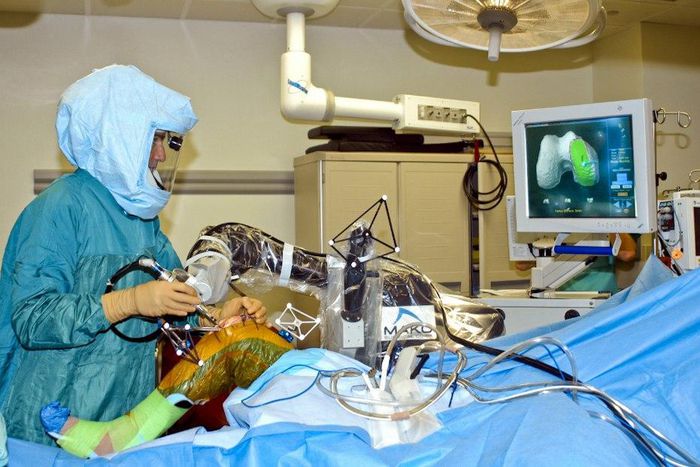 Robotic Assisted Partial Knee Replacement Surgery