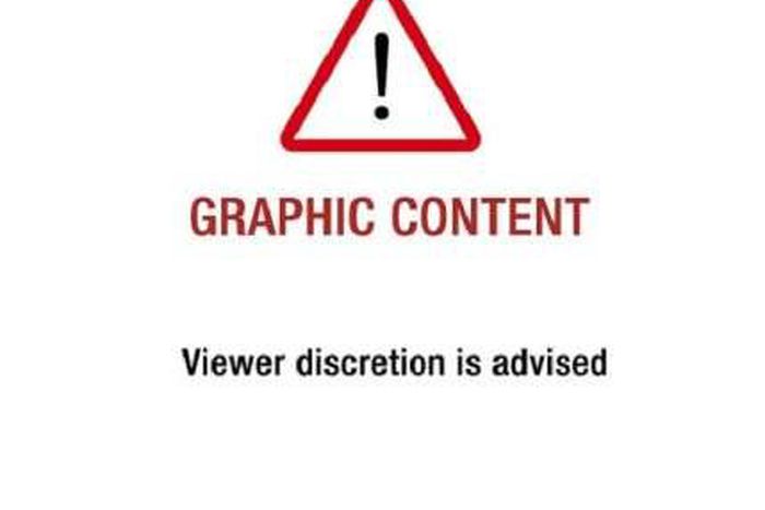 Wai án ƙone wani yaro mai shekara bakwai akan sata na Garriʼn rógo a jihar Lagos