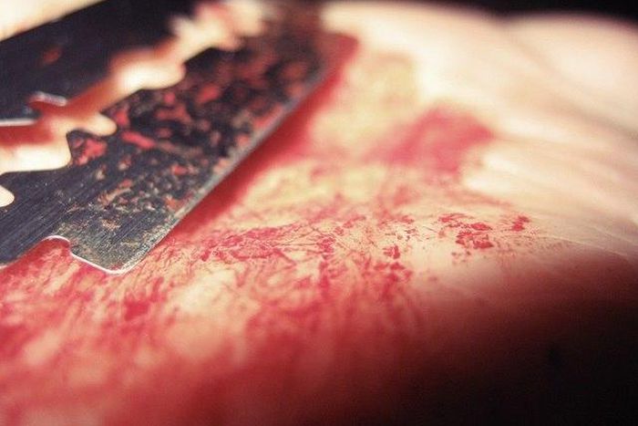 ___5039312___https:______static.pulse.com.gh___webservice___escenic___binary___5039312___2016___5___16___17___Bloody-Razor-Blade