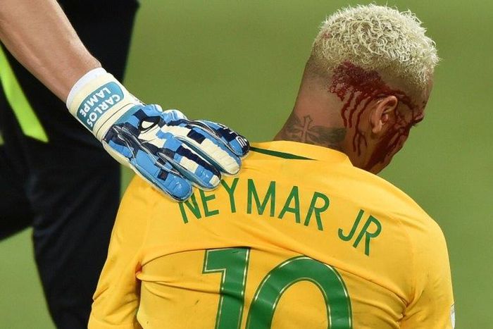 Brazil's Neymar bleeds after being injured in the face during the 2018 World Cup football qualifier against Bolivia in Natal, Brazil, on October 6, 2016