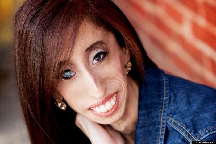 Once dubbed the 'world's ugliest woman,' Lizzie Velazquez shuts down viral memes shaming her
