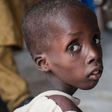 Malnourished boy at an IDP camp in Borno