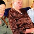 Members of the Albino Foundation of Nigeria