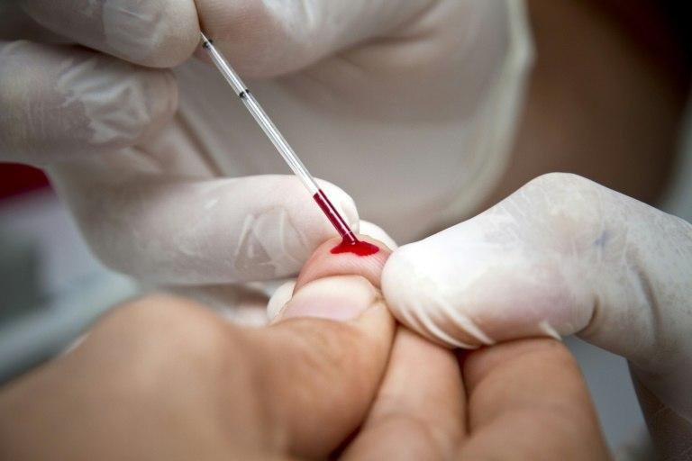 1 in 7 in Europe unaware of infection | Pulse Nigeria