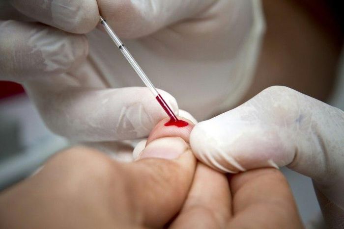 Europe registered its highest number of new HIV cases in a single year in 2015, at 153,407 cases, up from 142,000 in 2014, the WHO said