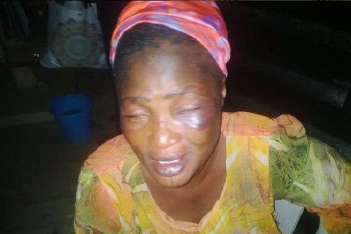 Gbemisola Igbara and her injuries