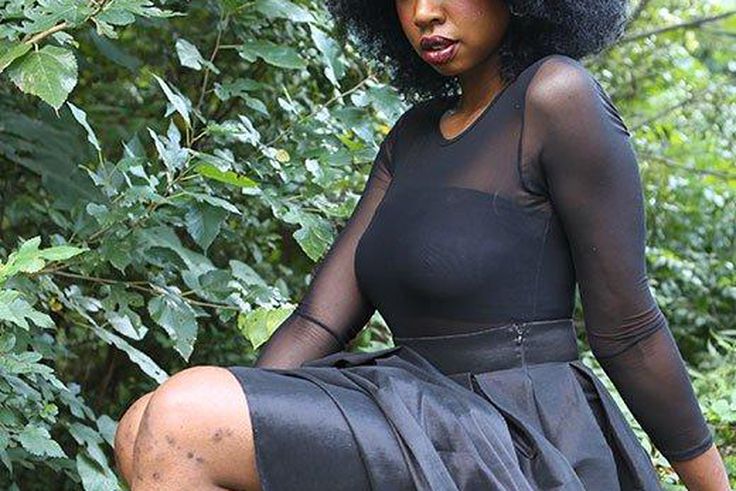 3 women explain what it’s really like to live with ailment