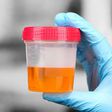 Urine can indicate if you have health issues