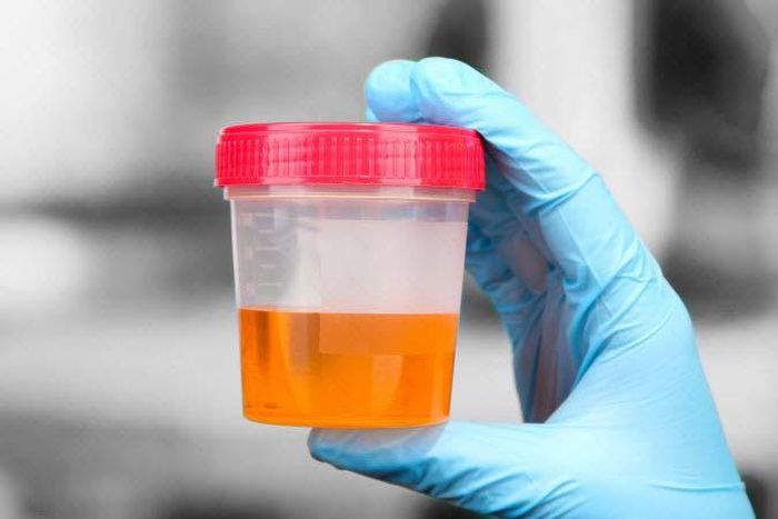 Urine can indicate if you have health issues