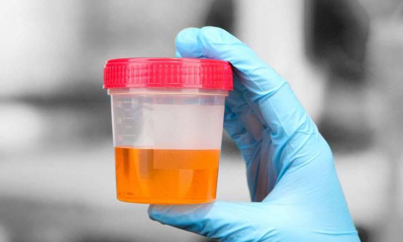 Urine can indicate if you have health issues