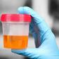 Urine can indicate if you have health issues