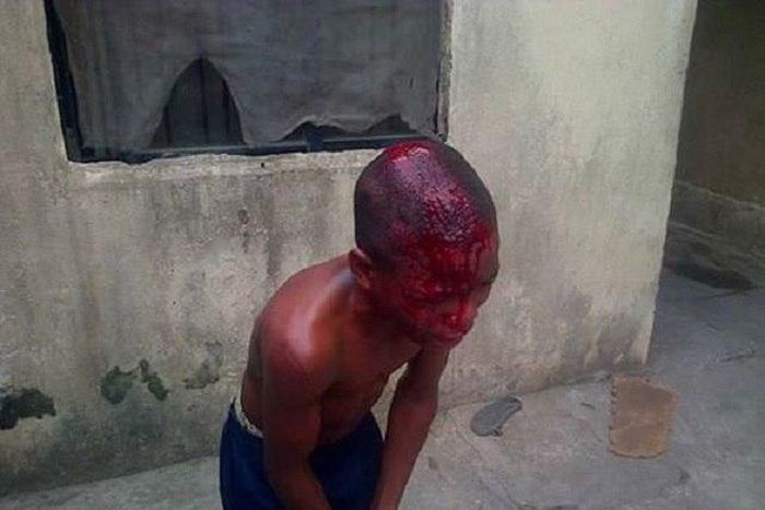 The bloodied houseboy