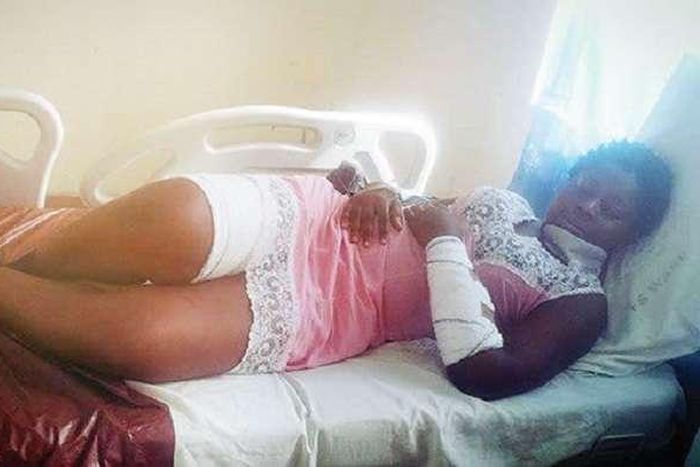 ʼƳar Ɓautan Ƙasa tana buƙatán Taimako domin cizon karnuka na Kocinʼta