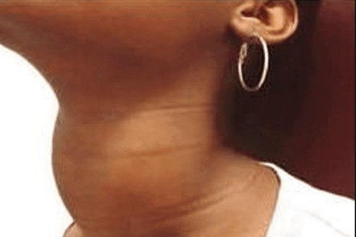 Here's what you need to know