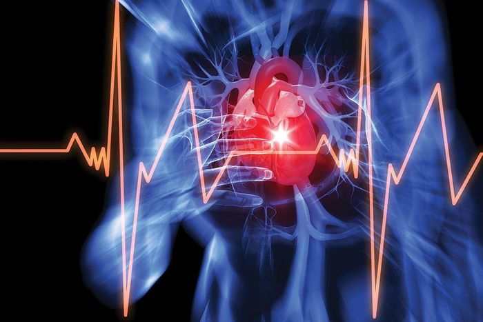 Nearly half of all heart attacks occur without you even knowing it