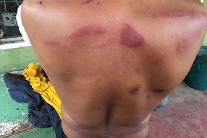 The brutalized Maxwell Nwosu