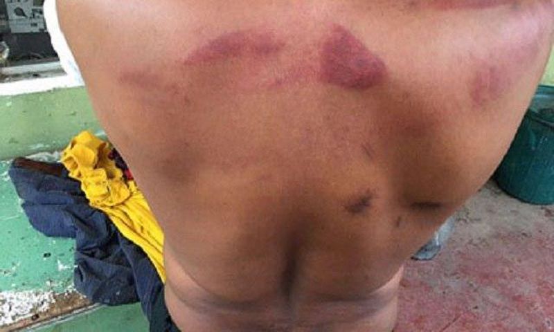 The brutalized Maxwell Nwosu