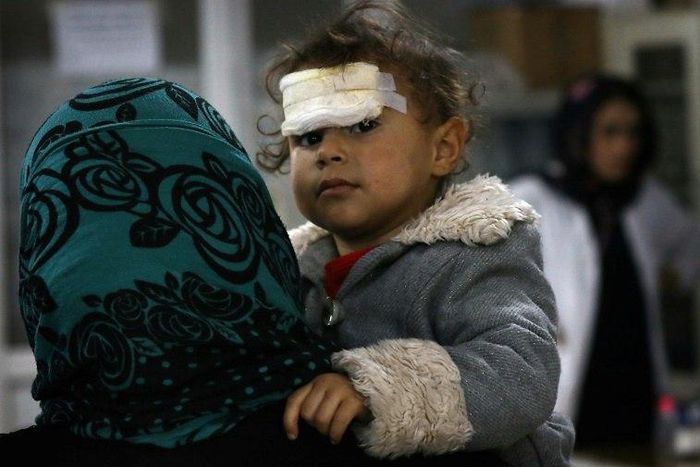 A wounded Iraqi child who was injured during the ongoing fighting between Iraqi forces and jihadists of the Islamic State group in Mosul, receives medical treatment at a hospital in Arbil on December 19, 2016