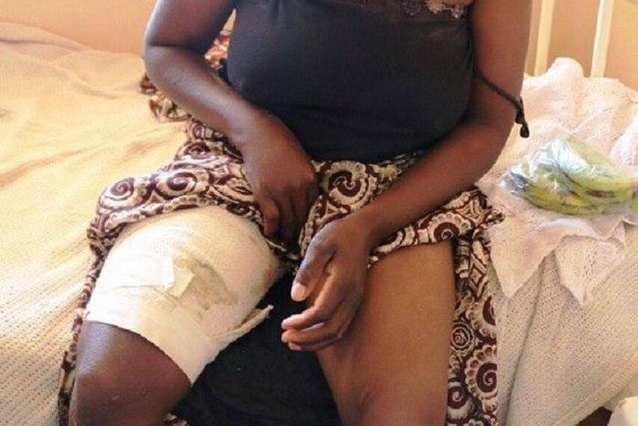 The injured Catherine Wakere