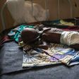 A young child suffering from severe malnutrition is treated at the In-Patient Therapeutic Feeding Centre in Maiduguri, northeastern Nigeria, on September 17, 2016