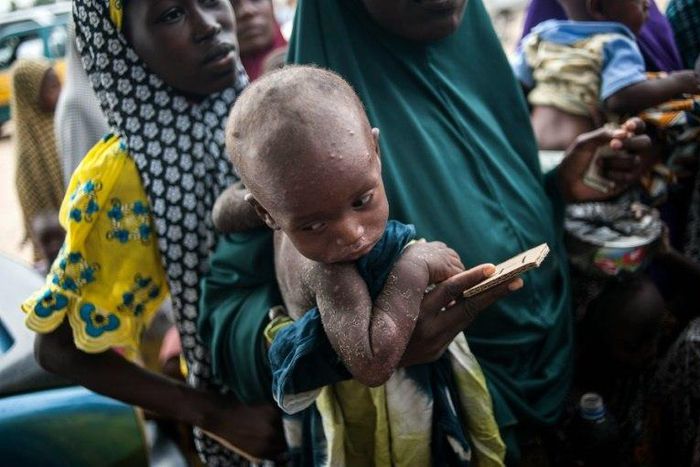 A woman holds her child while waiting in a queue at one of the UNICEF nutrition clinics in Muna informal settlement, in northeastern Nigeria in June 2016
