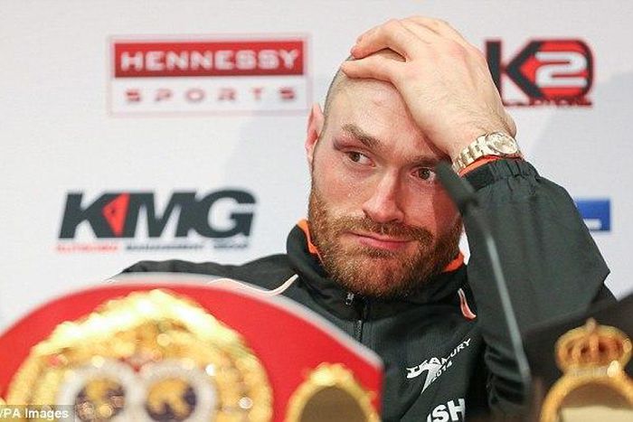 Tyson Fury