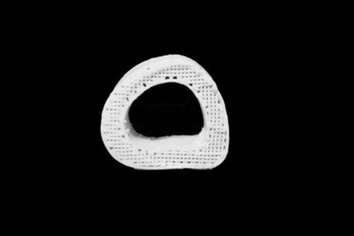 Scientists fix fractures with 3D-printed synthetic bone