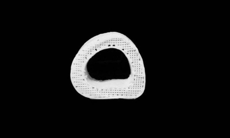 Scientists fix fractures with 3D-printed synthetic bone