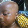 The infant with tribal marks