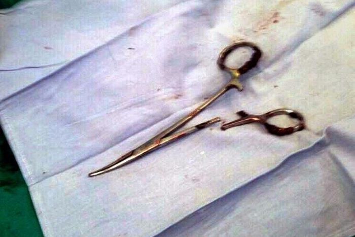 A pair of scissors which was removed from a patient's abdomen after being left behind during a surgery 18 years ago, at a clinic in the northern Vietnamese city of Thai Nguyen