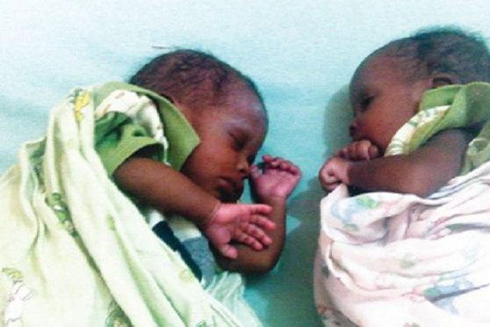 A set of twins (Illustration)