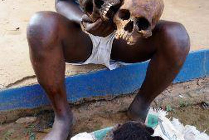Man found in possession of two human skulls.