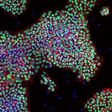 An image of human pluripotent stan cells in IαI media.