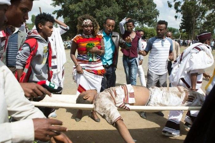 An injured man is carried away for treatment after the stampede in Bishoftu, southeast of Ethiopia's capital Addis Ababa, on October 2, 2016