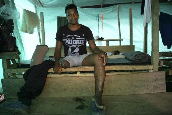 Blown through the air after stepping on a landmine, FARC guerrilla fighter Jair, says life was hard "when you've never been taught how to live after losing a leg"