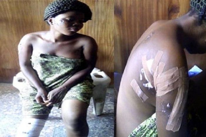 The injured Taiwo Kehinde