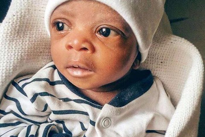 This child, Tobiloba Ademuyiwa needs urgent financial help for a surgery