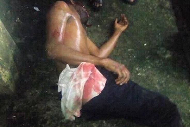 The injured student rapist