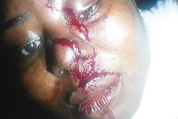 The injured Latifat Adeyemi