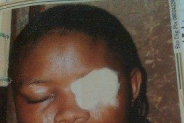 Woman docked in Lagos for biting off friend's eyelid